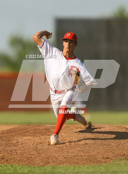 Thumbnail 2 in Bettendorf @ Davenport West photogallery.