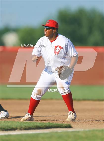 Thumbnail 2 in Bettendorf @ Davenport West photogallery.