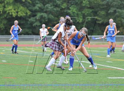 Thumbnail 2 in Arlington vs Carmel photogallery.