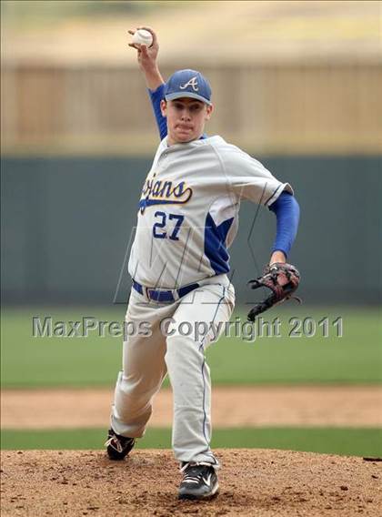 Thumbnail 1 in McNeil vs. Anderson (Rock Hardball Classic) photogallery.