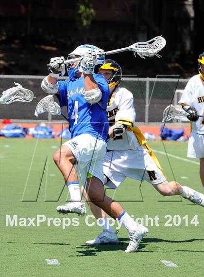 Thumbnail 2 in Acalanes @ Novato photogallery.