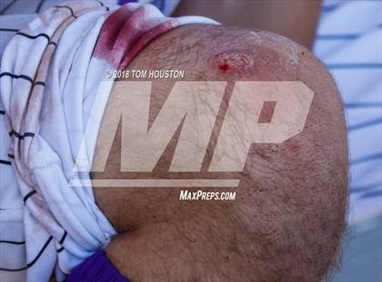 Thumbnail 1 in Torrance @ Rancho Cucamonga (CIF SS D3 Wildcard Playoff) photogallery.