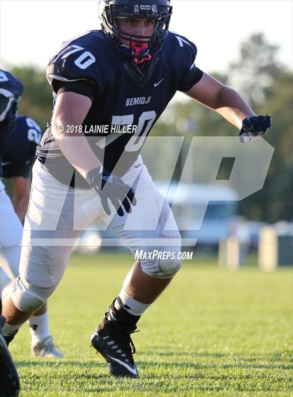 Thumbnail 1 in Bemidji vs West Fargo photogallery.