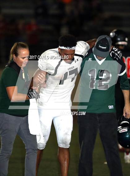 Thumbnail 1 in Kaiser @ Glendora photogallery.