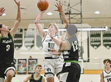 Thumbnail 2 in Westfield @ Pendleton Heights photogallery.