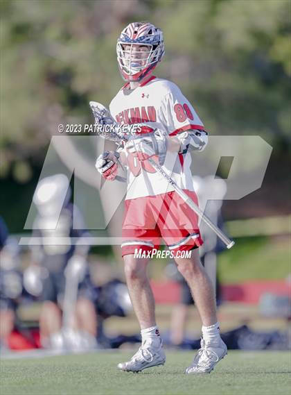 Thumbnail 1 in Laguna Hills @ Beckman photogallery.