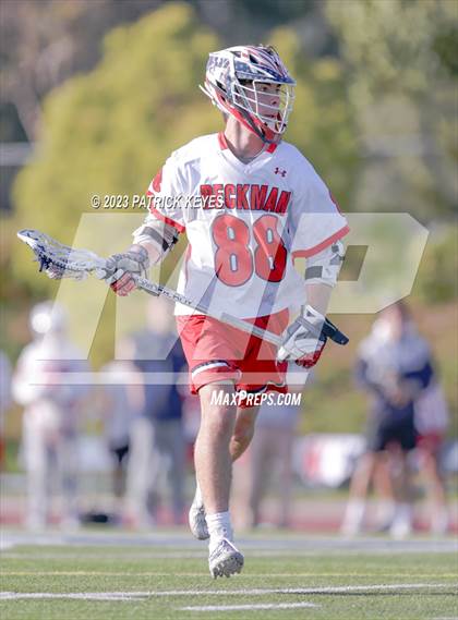 Thumbnail 3 in Laguna Hills @ Beckman photogallery.