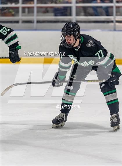 Thumbnail 1 in Upper St. Clair @ Pine-Richland photogallery.
