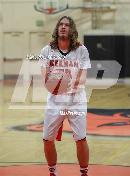 Thumbnail 1 in Kerman vs. McLane photogallery.