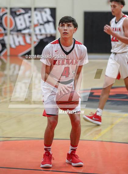 Thumbnail 1 in Kerman vs. McLane photogallery.