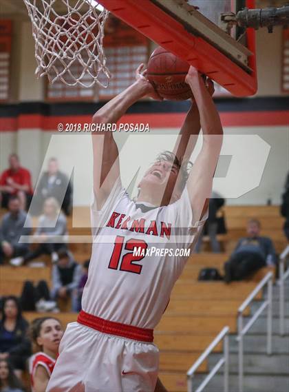 Thumbnail 2 in Kerman vs. McLane photogallery.