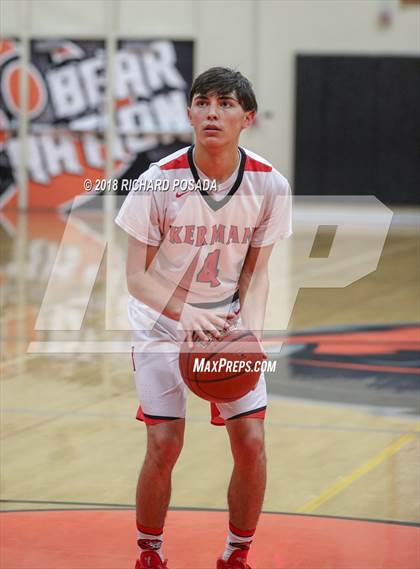 Thumbnail 1 in Kerman vs. McLane photogallery.