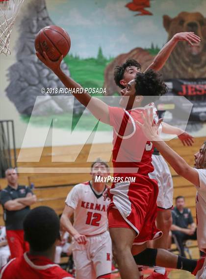 Thumbnail 2 in Kerman vs. McLane photogallery.