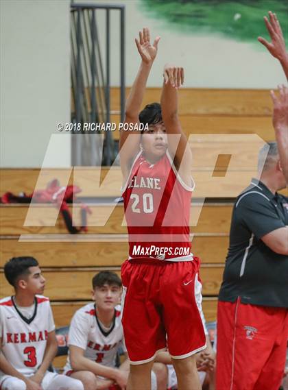 Thumbnail 3 in Kerman vs. McLane photogallery.