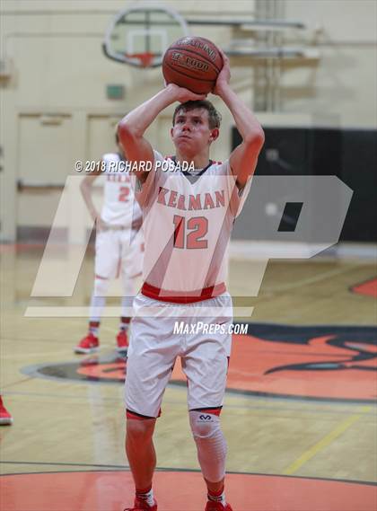 Thumbnail 1 in Kerman vs. McLane photogallery.