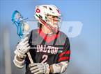 Photo from the gallery "Dalton @ Signal Mountain"