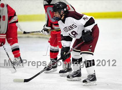 Thumbnail 2 in Conard @ North Haven photogallery.