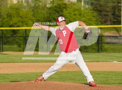 Thumbnail 1 in Greenwood @ Plainfield photogallery.
