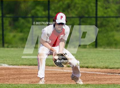 Thumbnail 2 in Greenwood @ Plainfield photogallery.