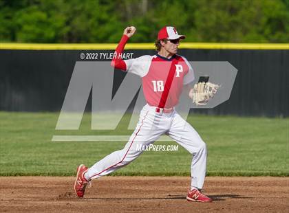 Thumbnail 1 in Greenwood @ Plainfield photogallery.