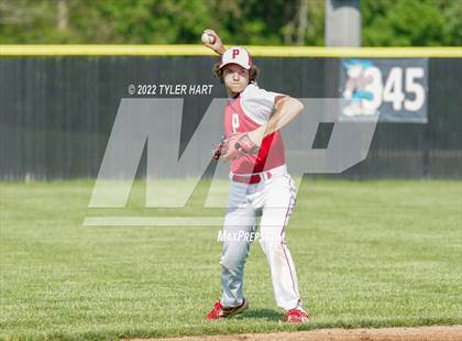 Thumbnail 1 in Greenwood @ Plainfield photogallery.
