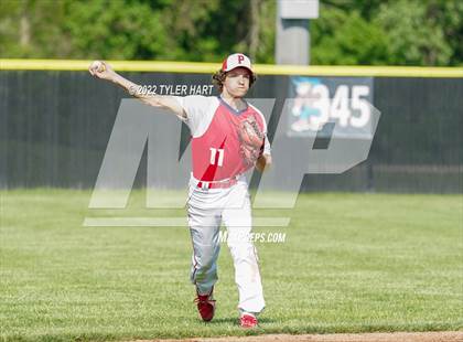 Thumbnail 2 in Greenwood @ Plainfield photogallery.