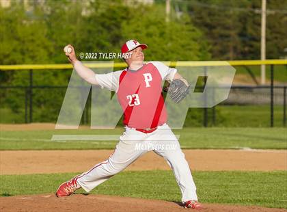 Thumbnail 2 in Greenwood @ Plainfield photogallery.