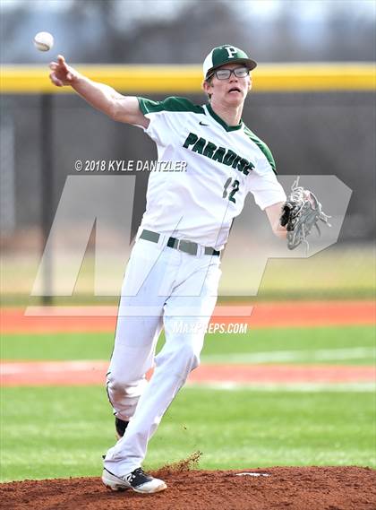 Thumbnail 2 in West vs Paradise (Brock Tournament) photogallery.