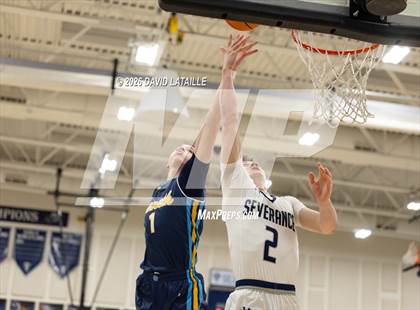 Thumbnail 2 in Timnath @ Severance photogallery.