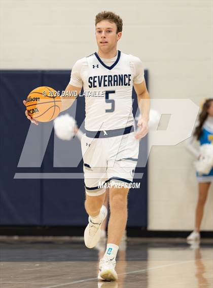 Thumbnail 3 in Timnath @ Severance photogallery.