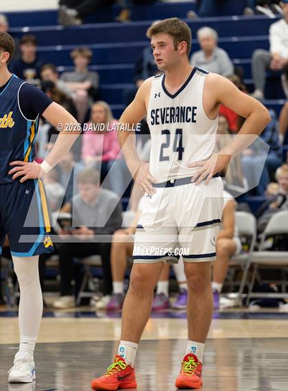 Thumbnail 2 in Timnath @ Severance photogallery.