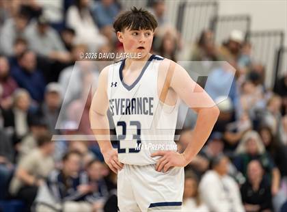 Thumbnail 2 in Timnath @ Severance photogallery.