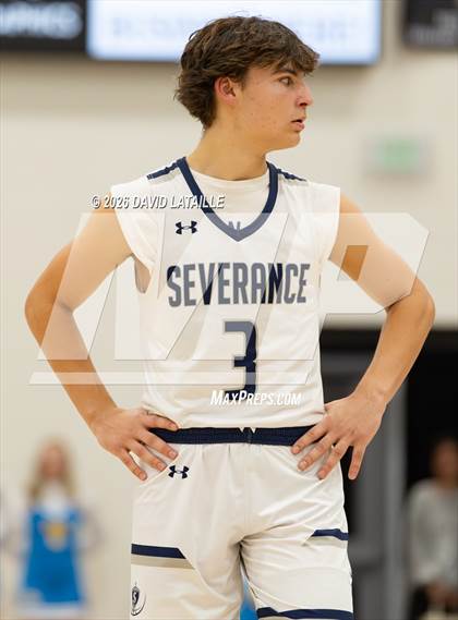 Thumbnail 3 in Timnath @ Severance photogallery.