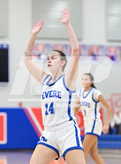 Thumbnail 3 in Tallmadge @ Revere photogallery.