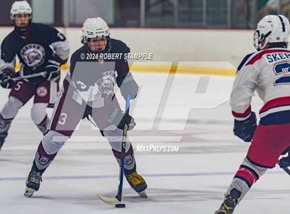 Thumbnail 3 in Beaver @ Shaler Area photogallery.