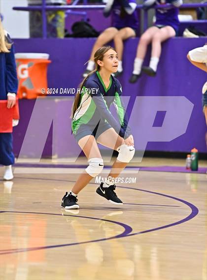 Thumbnail 1 in Kennedy vs Littleton photogallery.