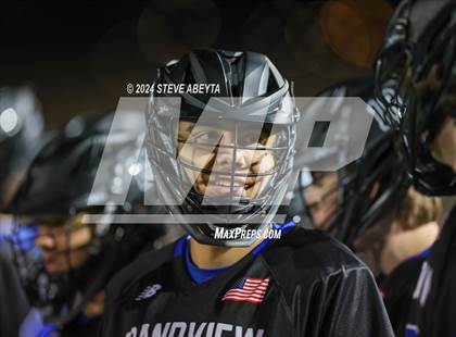 Thumbnail 2 in Chatfield @ Grandview photogallery.