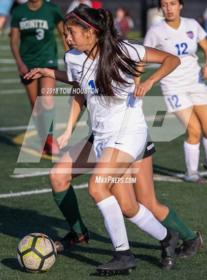 Thumbnail 1 in Bonita vs. Los Altos photogallery.