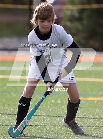 Thumbnail 2 in Triton Regional @ Pentucket Regional photogallery.