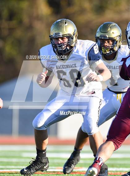 Thumbnail 3 in Hackensack @ Red Bank Regional photogallery.