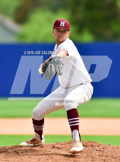 Thumbnail 1 in Brackenridge vs Highlands photogallery.