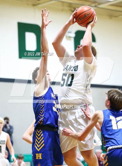 Thumbnail 3 in Huckabay vs Santo (Santo Tournament) photogallery.