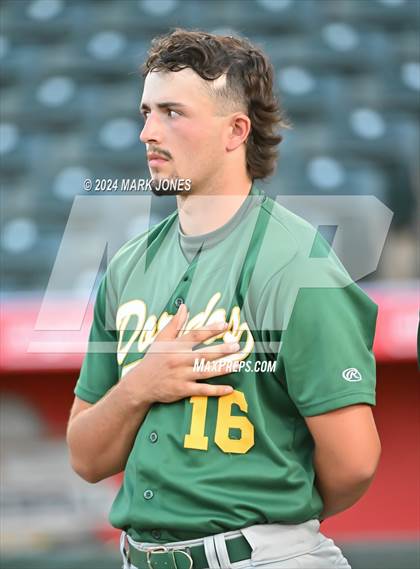 Thumbnail 1 in Saguaro vs. Canyon del Oro (AIA 4A Final) photogallery.