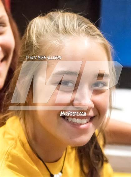 Thumbnail 1 in Hixson vs Notre Dame photogallery.