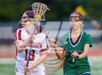 Thumbnail 3 in Grayson @ Union Grove photogallery.
