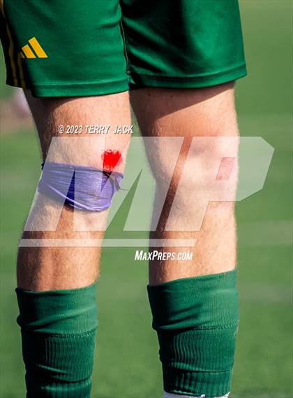 Thumbnail 2 in Edison vs. Millikan photogallery.