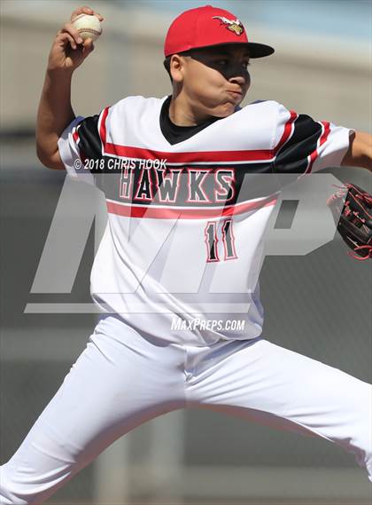 Thumbnail 1 in Sunnyside vs. Rio Rico (Lancer Baseball Classic) photogallery.