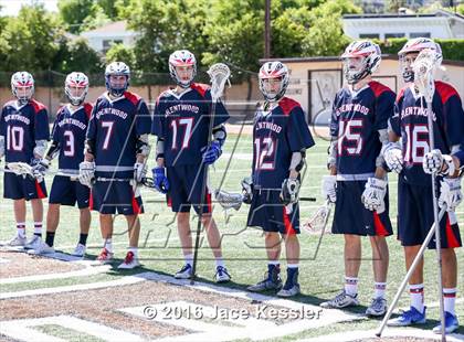 Thumbnail 2 in Brentwood School @ Crespi photogallery.