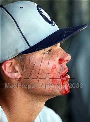 Thumbnail 1 in Chaminade @ Harvard-Westlake photogallery.
