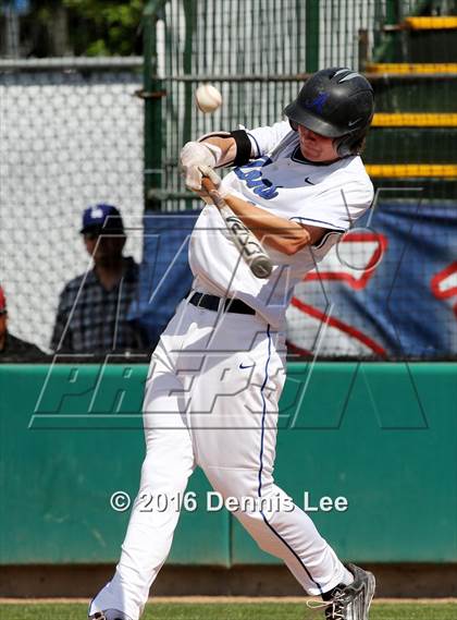Thumbnail 1 in Analy vs. Acalanes (CIF NCS D3 Final) photogallery.